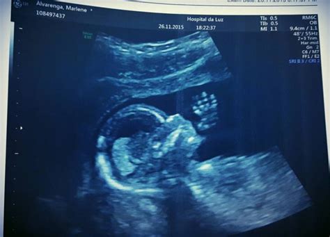 2 1 2 2 1. Jogador do Benfica Nelson Semedo vai ser pai - MoveNotícias