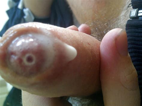 My Dripping Wet Uncut Cock 1 Pics