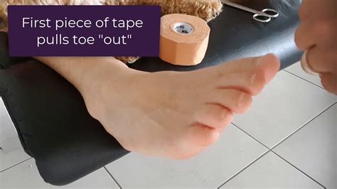 How To Hold A Curly Pinky Toe Straight With Tape Youtube