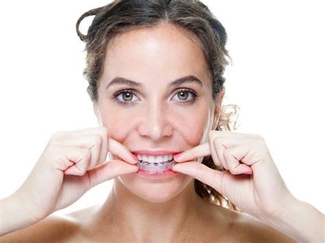 Pflege Ihrer Invisalign Aligner Aesthetic Dentistry