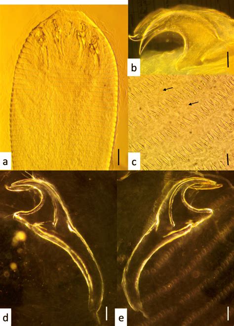 Light Micrographs Of The Nymphs Of Linguatula Serrata Collected From