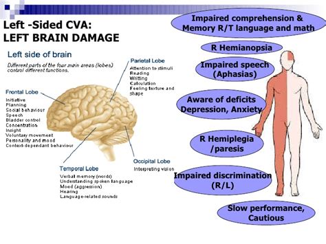 Left Hemisphere Stroke Milka Clarke Stroke Brain Trauma Foundation