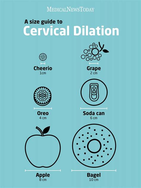 Cervical Dilation Chart Printable