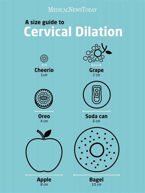 We did not find results for: Cervix dilation chart: Stages of labor and what to expect