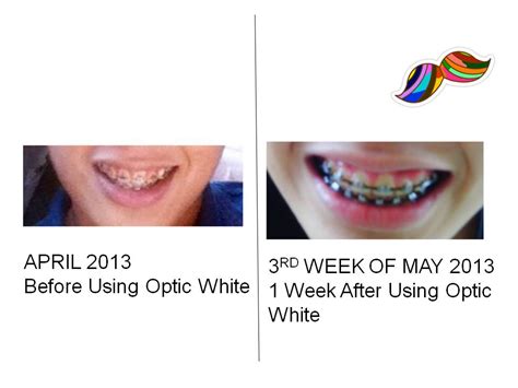 Why do you use a whitening toothpaste to whiten teeth? Mr. Pogi Tips: Colgate Optic White Toothpaste Review