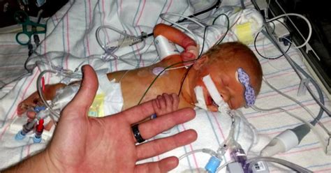 Six Day Old Baby Survives Heart Transplant In Phoenix Arizona Cbs News