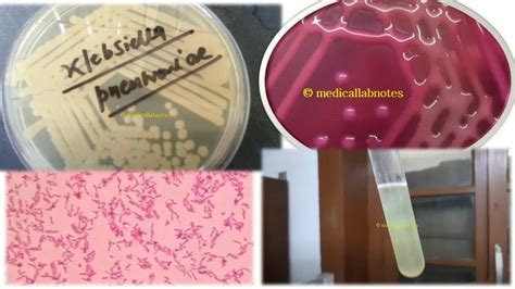 Enterobacteriaceae Introduction Phenotypic Features Keynotes