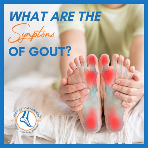 What Are Gout Symptoms Foot And Ankle Centers Of Frisco And Plano