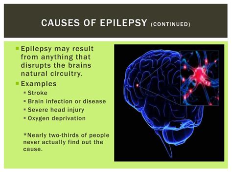 Ppt Epilepsy Powerpoint Presentation Free Download Id2841428