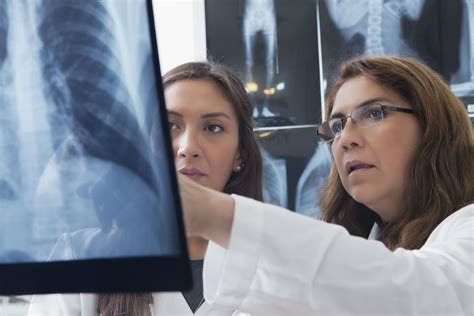Doctor Specialist Pulmonary Medicine Holding Radiological Chest X Ray SexiezPix Web Porn
