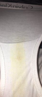 Tmi Weeks Days Weird Stain On Panties Should I Be Worried Babycenter