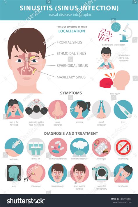 Nasal Diseases Sinusitis Sinus Infection Diagnosis Stock Vector