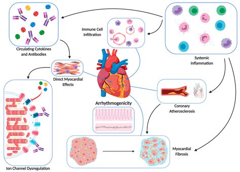 Diagnostics | Free Full-Text | Arrhythmogenic Inflammatory Cardiomyopathy in Autoimmune 