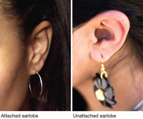 Two Pictures Of The Same Ear With Different Shapes And Sizes One Is