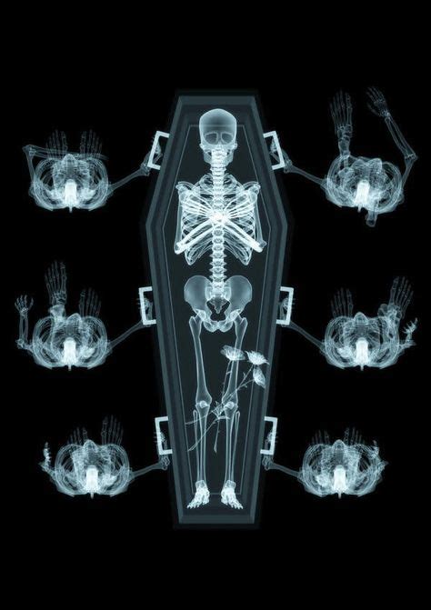 250 x ray ideen in 2021 röntgenbilder röntgen nacktscanner