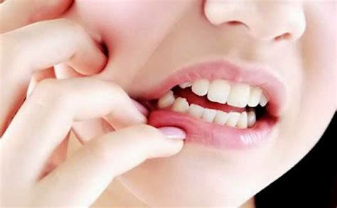 Cara Menghilangkan Sakit Gigi Paling Berkesan
