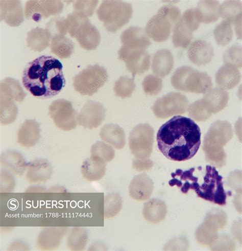 Microphotograph Of A Smear Of Human Blood In Which Erythrocytes