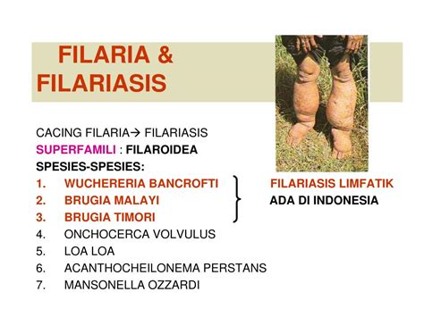 Ppt Filaria And Filariasis Powerpoint Presentation Free Download Id