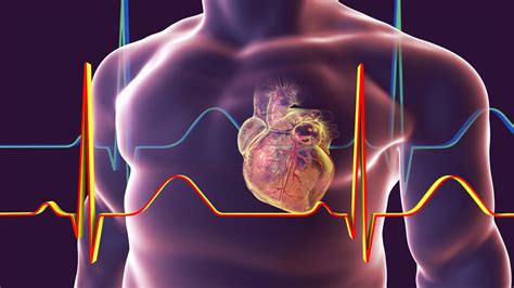 Enlarged Heart Causes Symptoms And Treatment Health Hearty