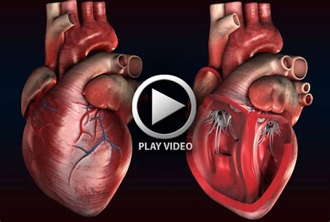 How The Heart Works Animated Video Medical Estudy