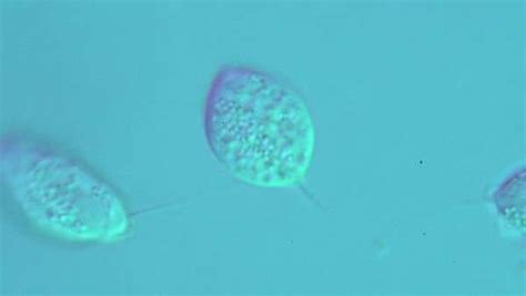 Trichomonas Vaginalis Parasite Light Microscopy Stock Video Footage