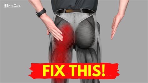 Numbness in lower back can be caused by various conditions such as pinched nerves, herniated disc, etc. The QUICKEST Way to Get Sciatic Leg Pain Relief ...