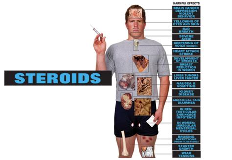 Are Steroids Safe Of Course Not The Elevated Male Total Body