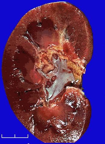 Pokoknya benelli leoncino 250 very nice bike, good design motorcyle. MP: Gambar Penyakit Ginjal dan Hati