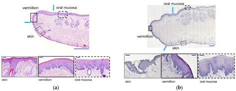 Vermilion Border Of Lip Histology