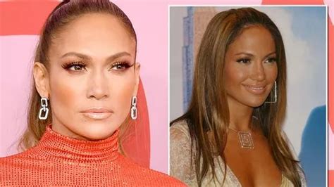 Surgeon Reveals What Jennifer Lopez Has Really Had Done From Her Nose