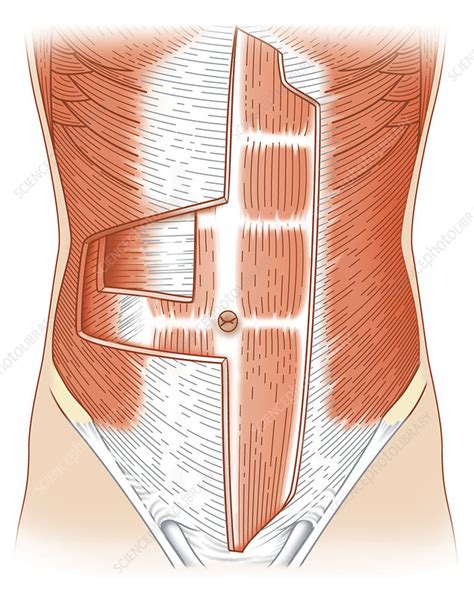 Abdominal Muscle Layers Artwork Stock Image C0107080 Science