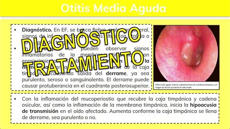 ⚕️🩺 Otitis Media Agudaoma 23 Otorrinolaringología Youtube