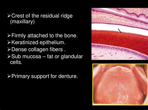 Histology Of Oral Mucous Membrane And Gingiva