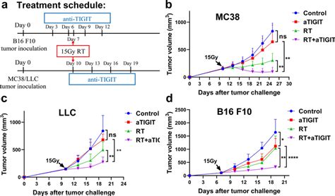 RT And Anti TIGIT Therapy Showed Synergistic Anti Tumor Effects In