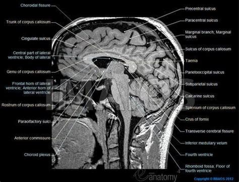 Normal brain anatomy as demonstrated by computerized tomography (ct scanning). Anatomy of the brain (MRI) | Mri brain, Anatomy, Mri