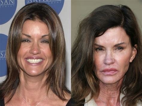 Antes y después celebridades que lucen irreconocibles por la cirugía