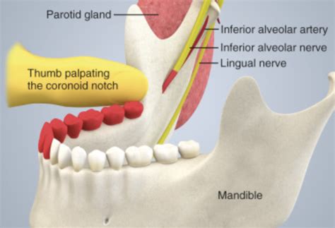 Inferior Alveolar Nerve Block Landmarks