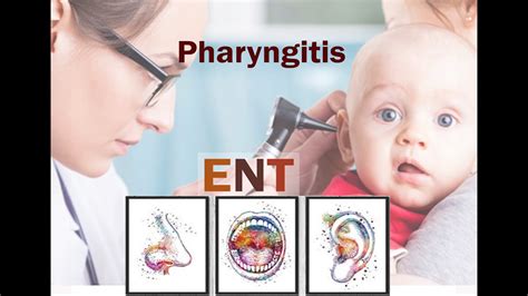 Ent Pharynx Pharyngitis Youtube