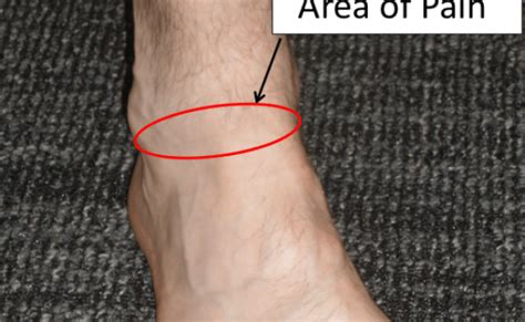 Anterior Ankle Pain Front Symptoms Causes Treatment Otosection