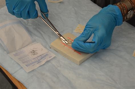 47 Suture Removal Clinical Procedures For Safer Patient Care