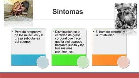 Trastornos Nutricionales En Pediatria Marasmo Kwashiorkor Mixta Ppt