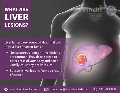 What Are Liver Lesions Autoimmune Disorder Digestive Health