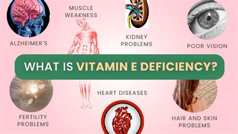 What Is Vitamin E Deficiency Causes Symptoms Complications Free