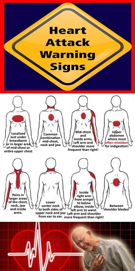 Heart Attack Warning Signs Heart Attack Warning Signs