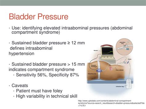 Ppt Acute Kidney Injury Powerpoint Presentation Free Download Id