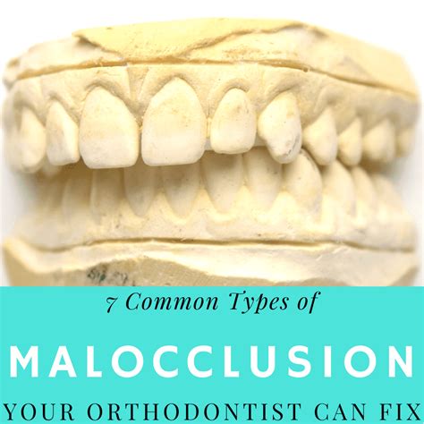 7 Common Types Of Malocclusion That Your Orthodontist Can Fix