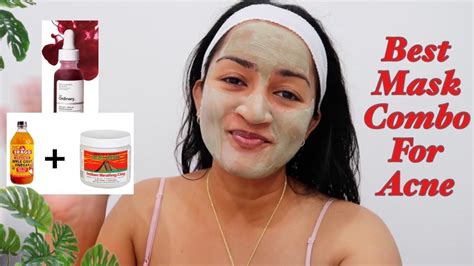 Best Face Mask For Acne Youtube