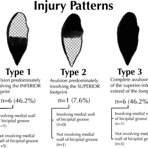 This Diagram Shows The Three Types Of Injury Patterns Involving The