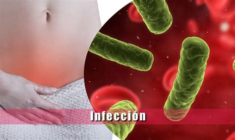 Infeccion Causas Sintomas Virus Y Bacterias Guía Medica Familiar