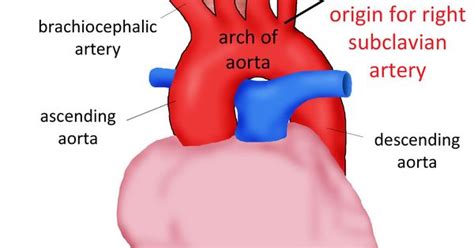 What I Know But Without The Official Word Subclavian Artery And Search